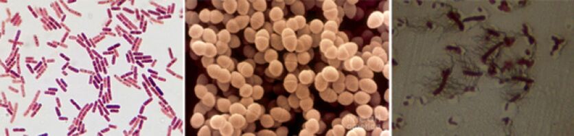 E. coli, Enterococcus feces and pro-chronic bacterial prostatitis