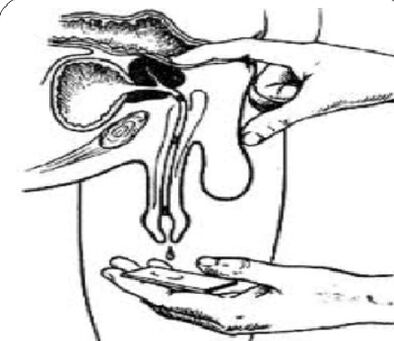 Massage the prostate to get secretions