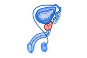 Prostate inflammation diagram