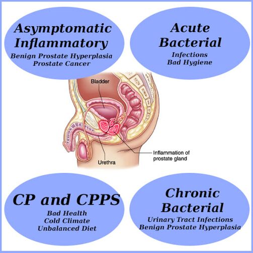 Causes of prostatitis